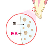 ホワイトニングのメカニズム@