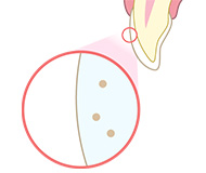 ホワイトニングのメカニズムB